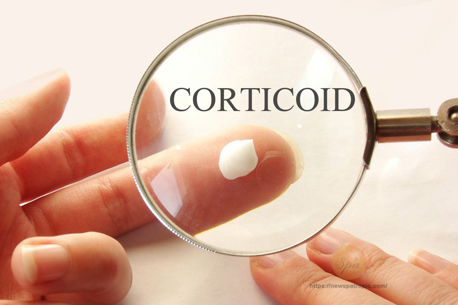 Corticoid là nhóm dược chất có tính kháng viêm mạnh với da