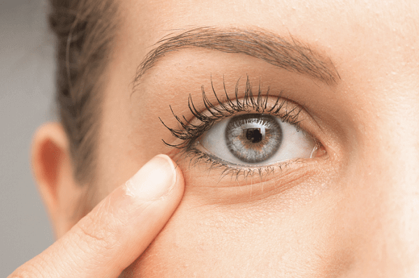 Thức khuya sẽ ảnh hưởng xấu đến vùng da xung quanh mắt